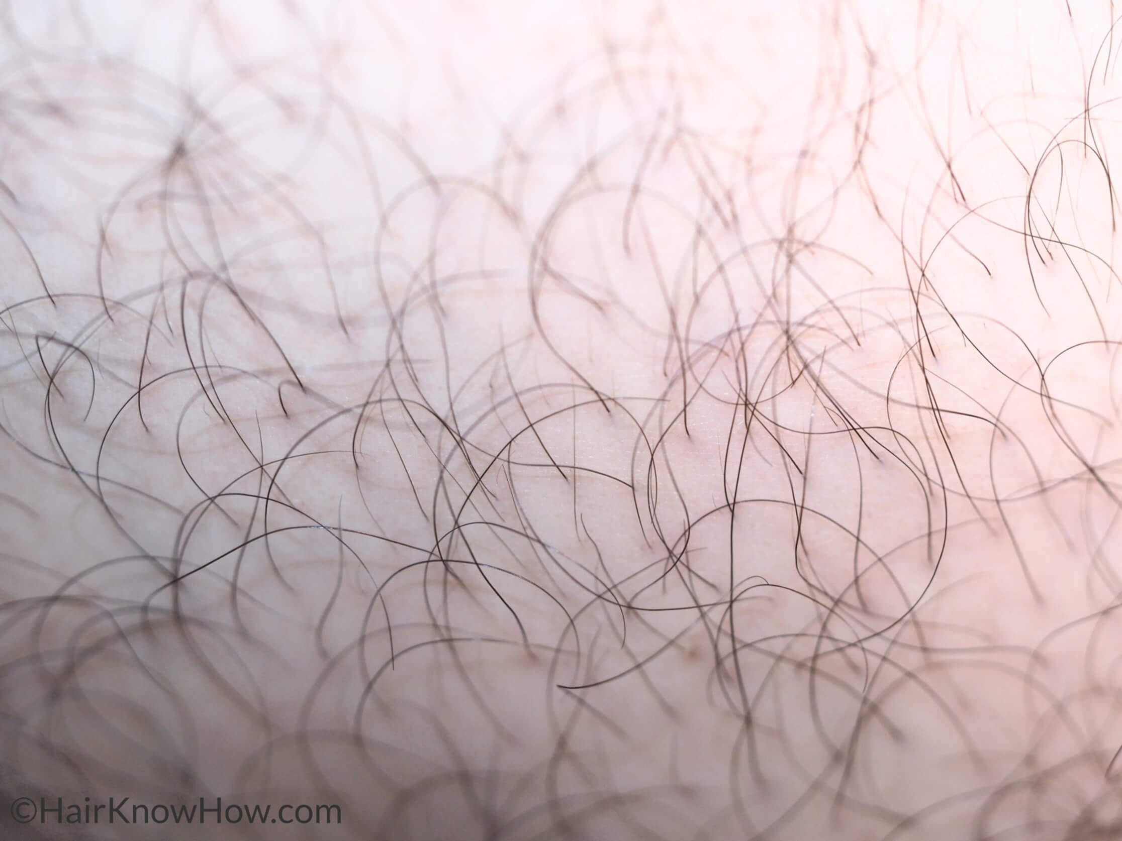 Hair Growth Learn The Science That Determines How Fast Your Hair Grows HairKnowHow.Com Professional Hair Testing Services Hair Clinics Trichologists Private Clients